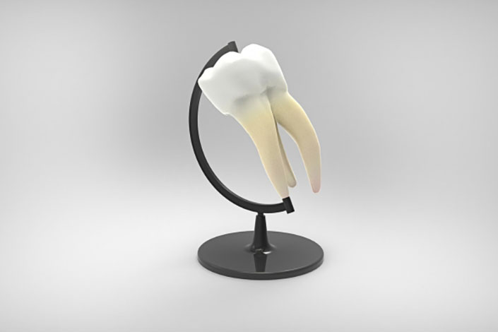 Ästhetische Füllungen